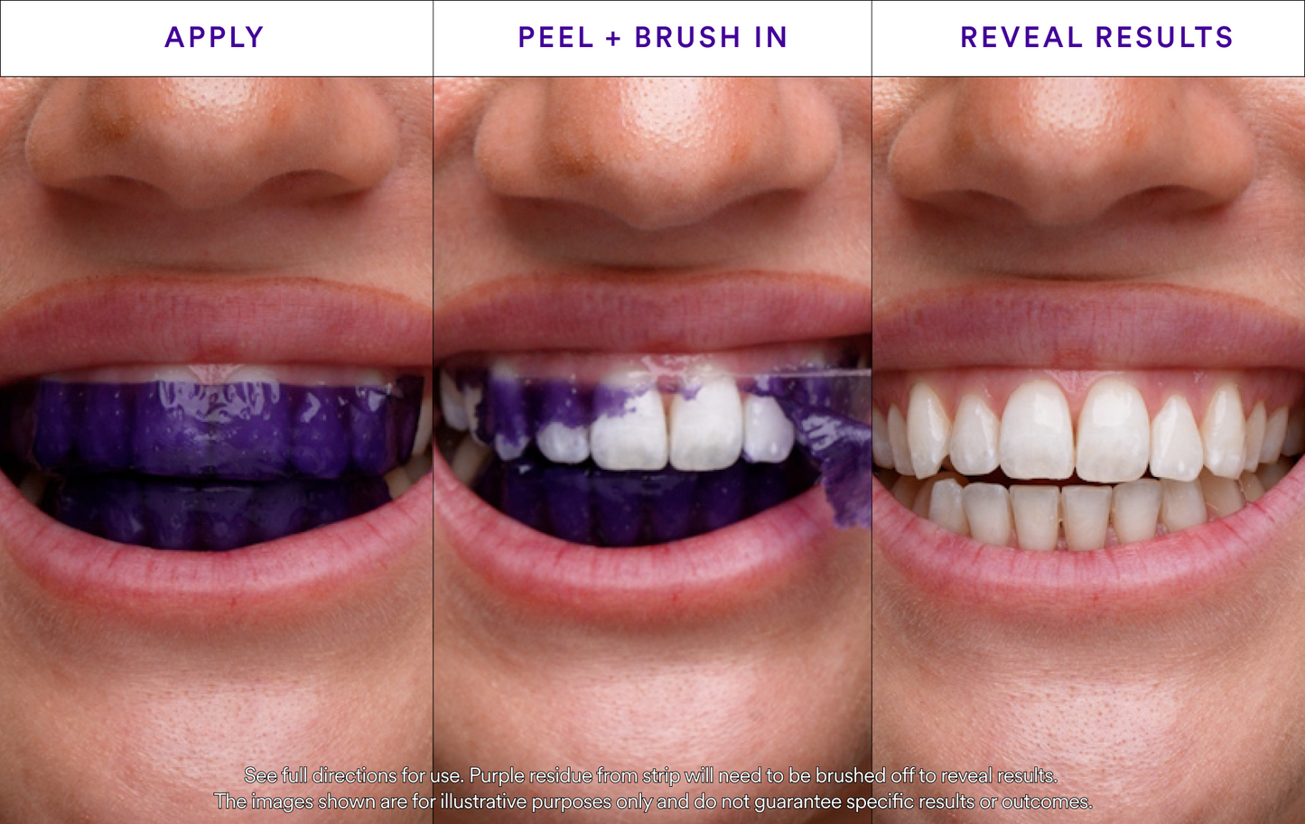 Gleammore Whitening Strips